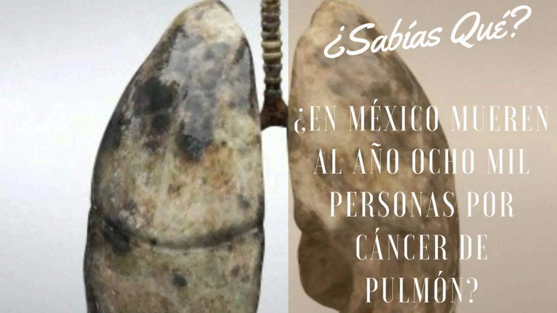 Cáncer de Pulmón